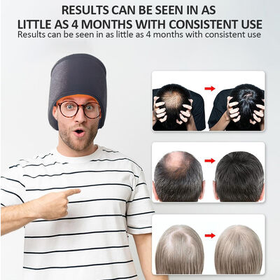 660nm Cap wzrostu włosów Led terapii czerwonym światłem i 270 Led czerwonym światłem i laserowej terapii Cap